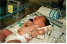 baby-jean-paul-testimonial-1